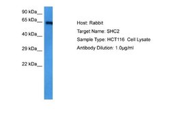 SHC2 Rabbit anti-Human, Polyclonal, Novus Biologicals 0.1 mL | Buy Online | Novus Biologicals | Fisher Scientific